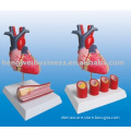 The dissection model of natural size heart (attach with diseased artery vas)